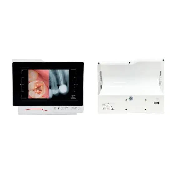 Câmera intraoral imagem 5